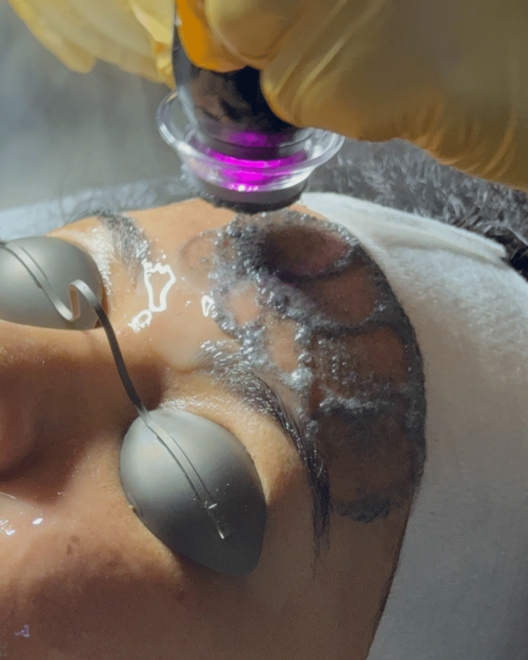 Glo2 Facial